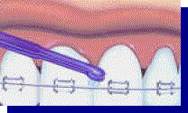 advise10.jpg (7767 bytes)