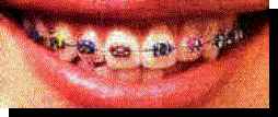 brace1.jpg (7113 bytes)
